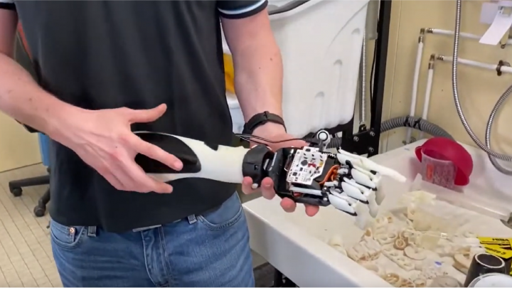 Prothèse de main myoélectrique