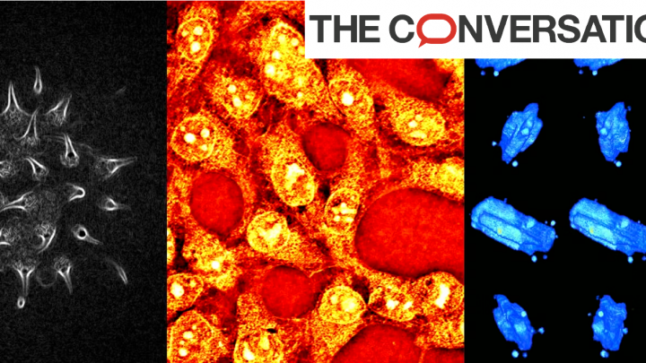 3 images prises au microscope